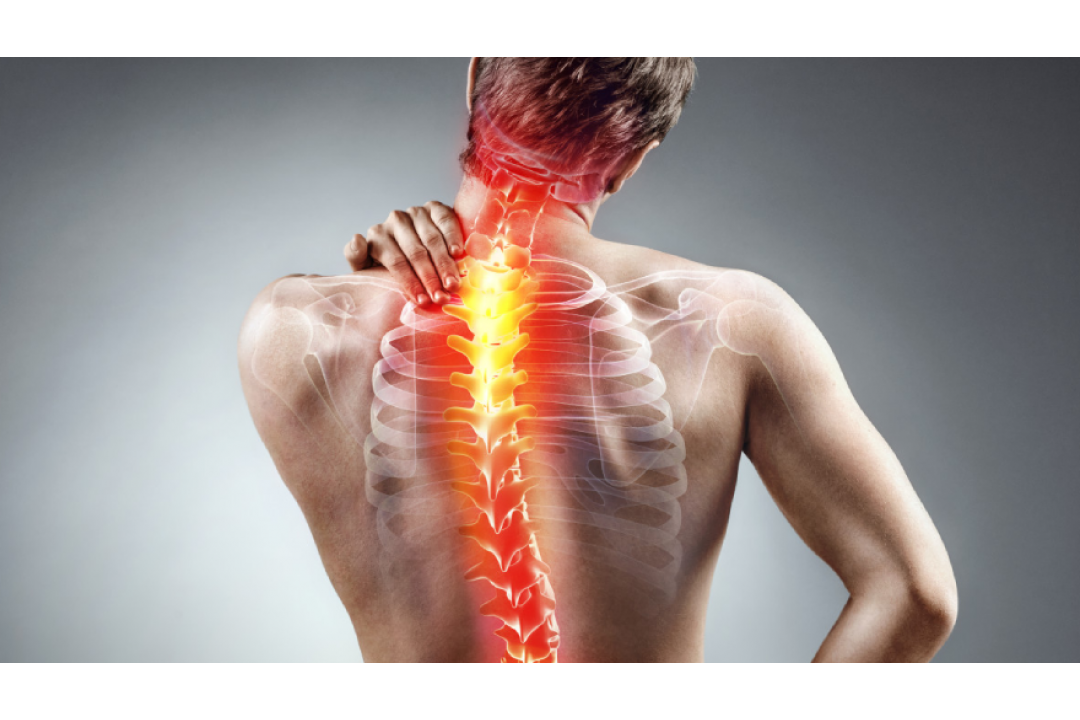 Cattiva postura e dolori articolari 