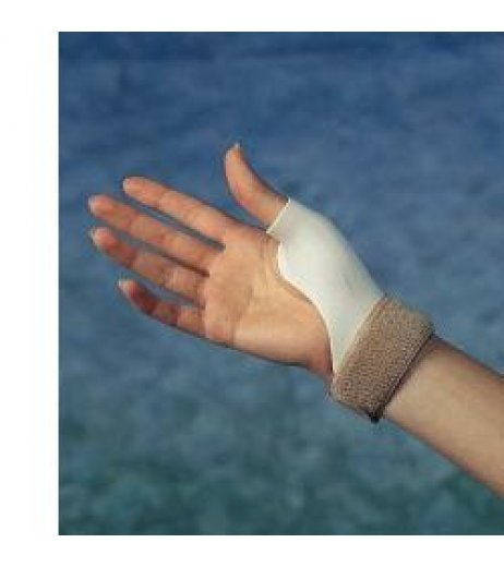 RO+TEN Ort.Poll.Sx Daumfix XL RO+TEN Ort.Poll.Sx Daumfix XL